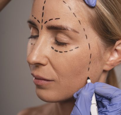 woman-preparing-cosmetic-surgery (1)